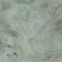 Rhizoctonia