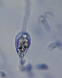 zoospores